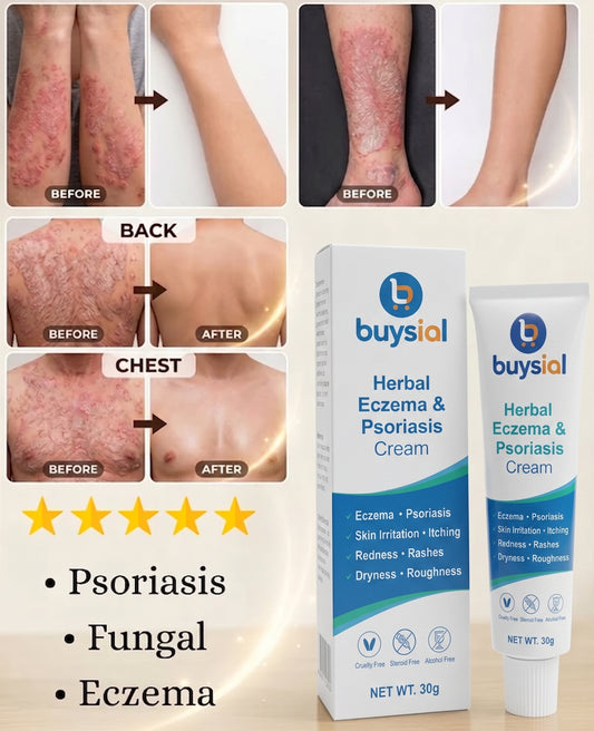 Buysial Herbal Eczema & Psoriasis Cream