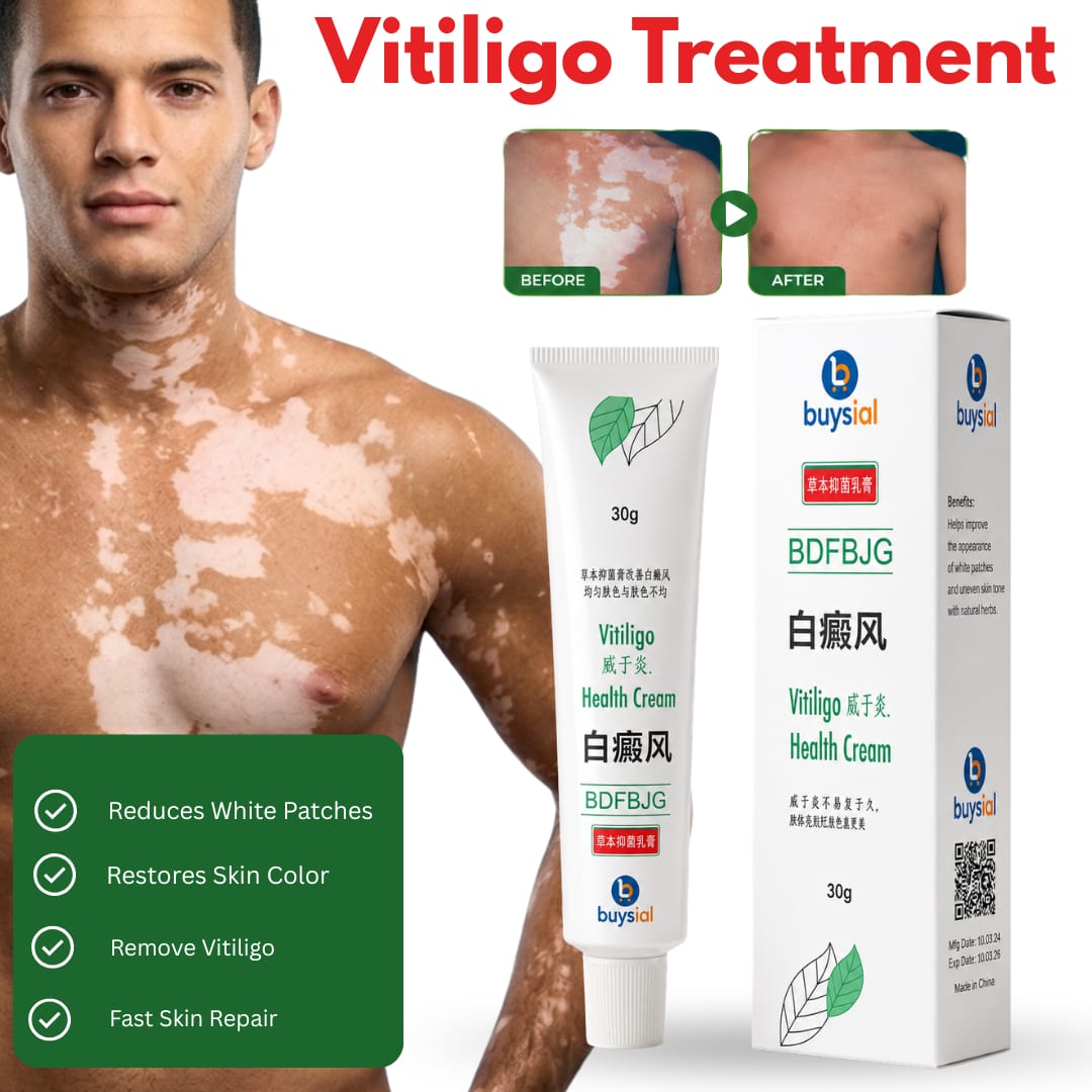 Vitiligo Cream