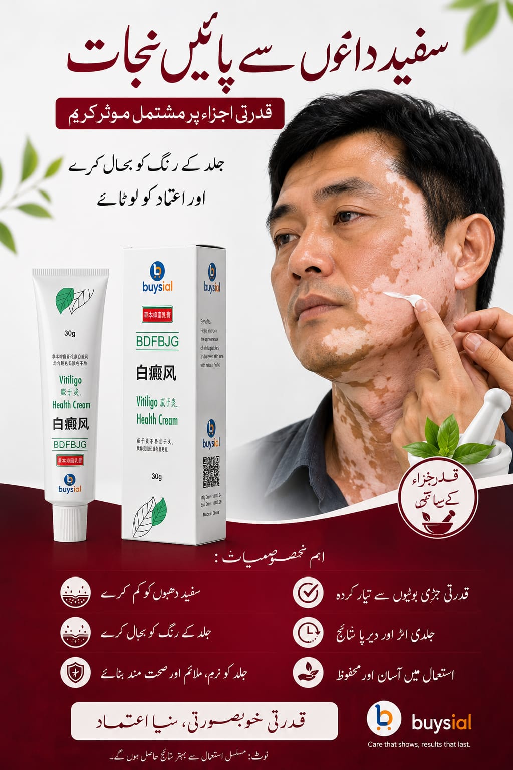 Vitiligo Cream