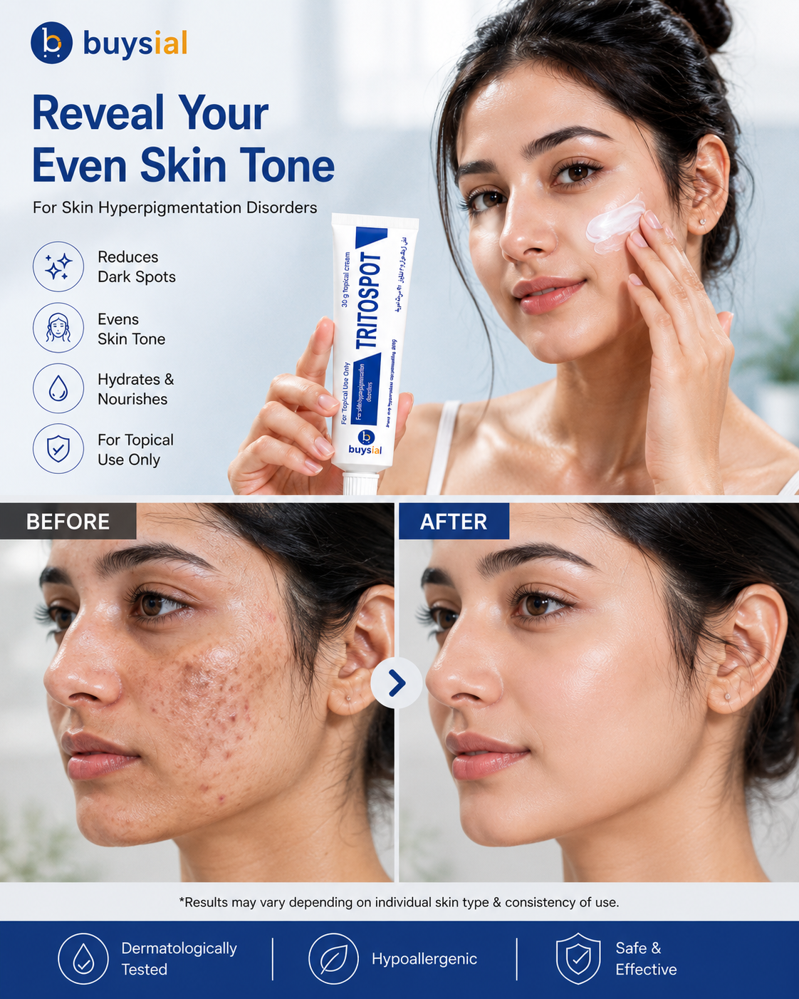 Buysial TRITOSPOT™ Cream 30g | Hyperpigmentation, Dark Spots & Melasma Treatment | Dermatologist Recommended | For Men & Women