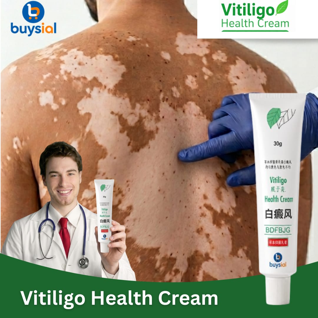 Vitiligo Cream